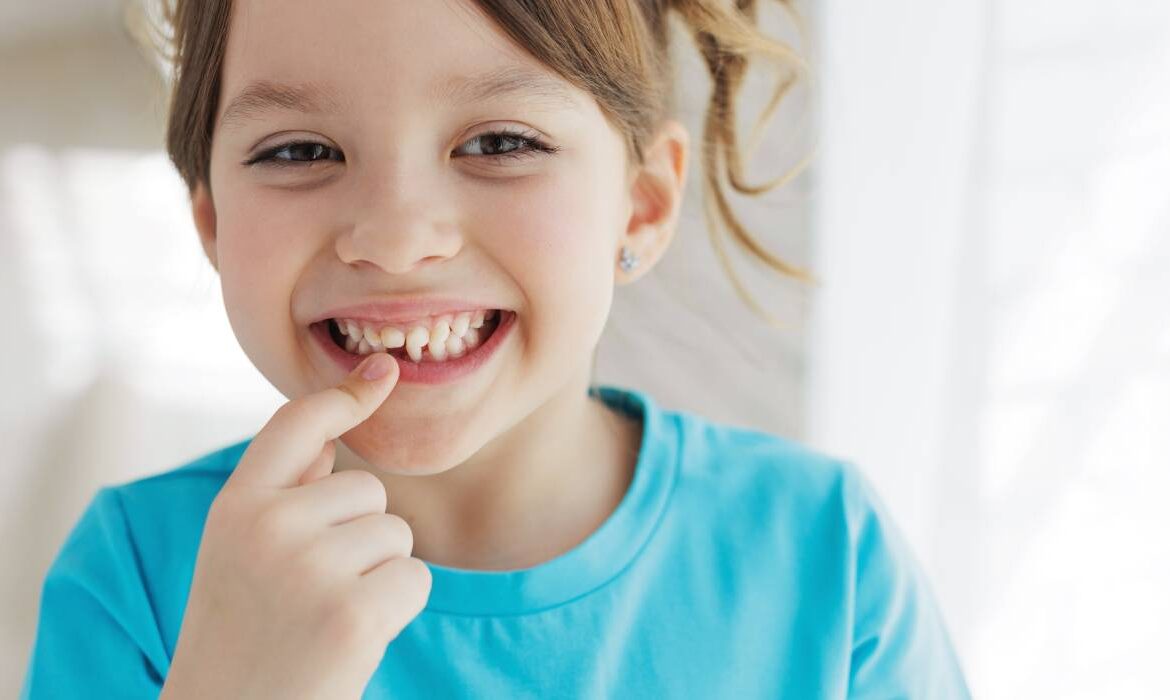 Transpoziția dentară la copii: ce înseamnă, de ce apare și când e nevoie de tratament?