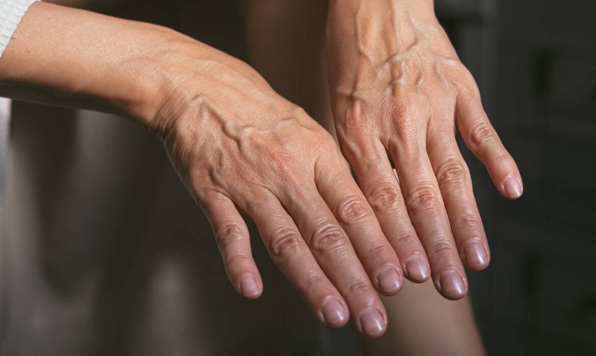 Corpul nu îmbătrânește treptat, ci în „salturi”. Vârstele la care apar cele mai importante schimbări
