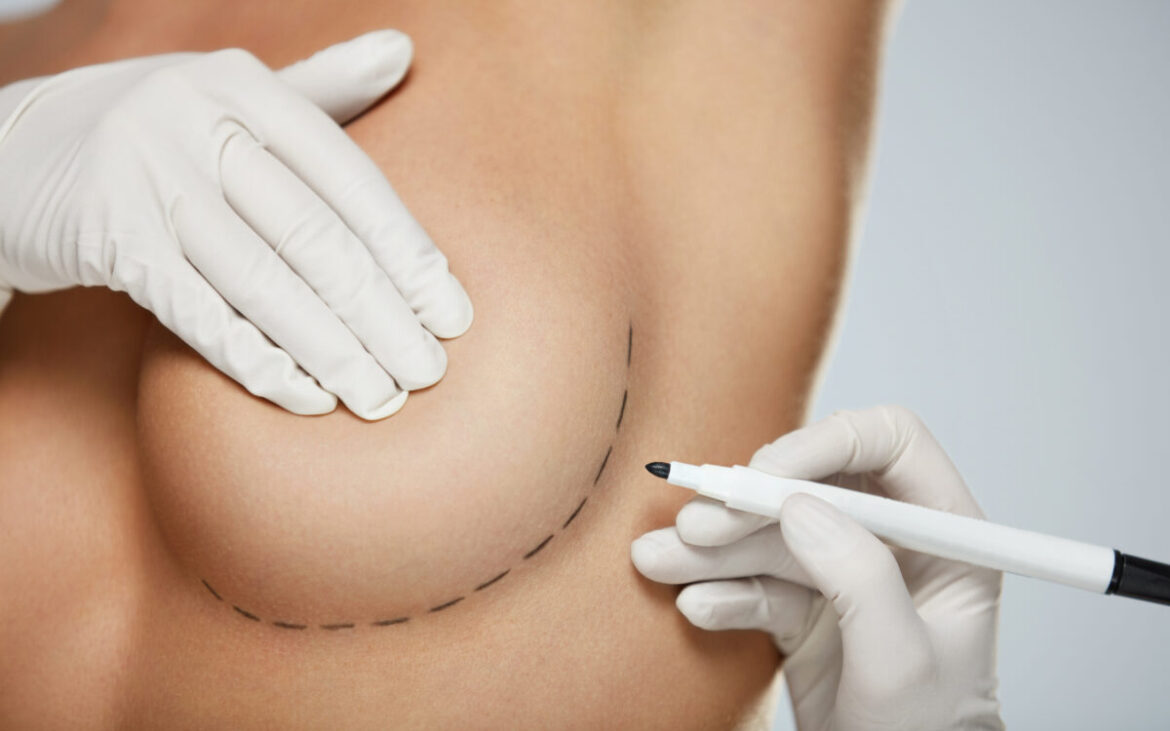 Implanturile mamare pot afecta alăptarea: adevăr sau minciună?