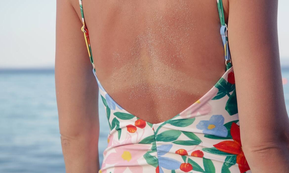 Dr. Andreea Domnițeanu, medic dermatolog: Nu există bronz natural și sănătos atunci când vorbim despre expunerea la soare