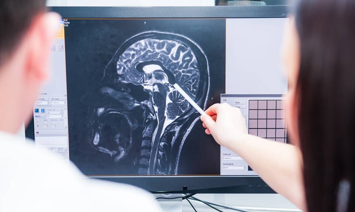 Cum să-ți menții creierul sănătos. Obiceiuri recomandate de neurolog, care previn declinul cognitiv
