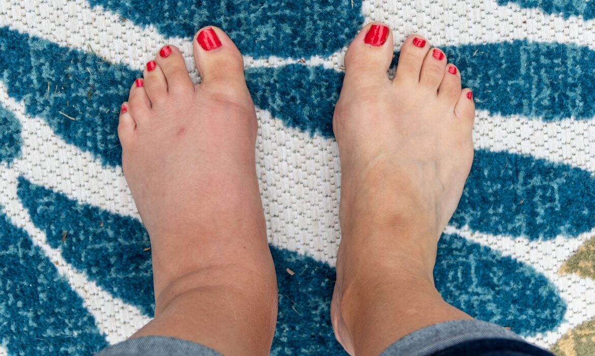 Semnele ascunse de pe picioare care pot indica probleme grave de sănătate. La ce trebuie să fii atent