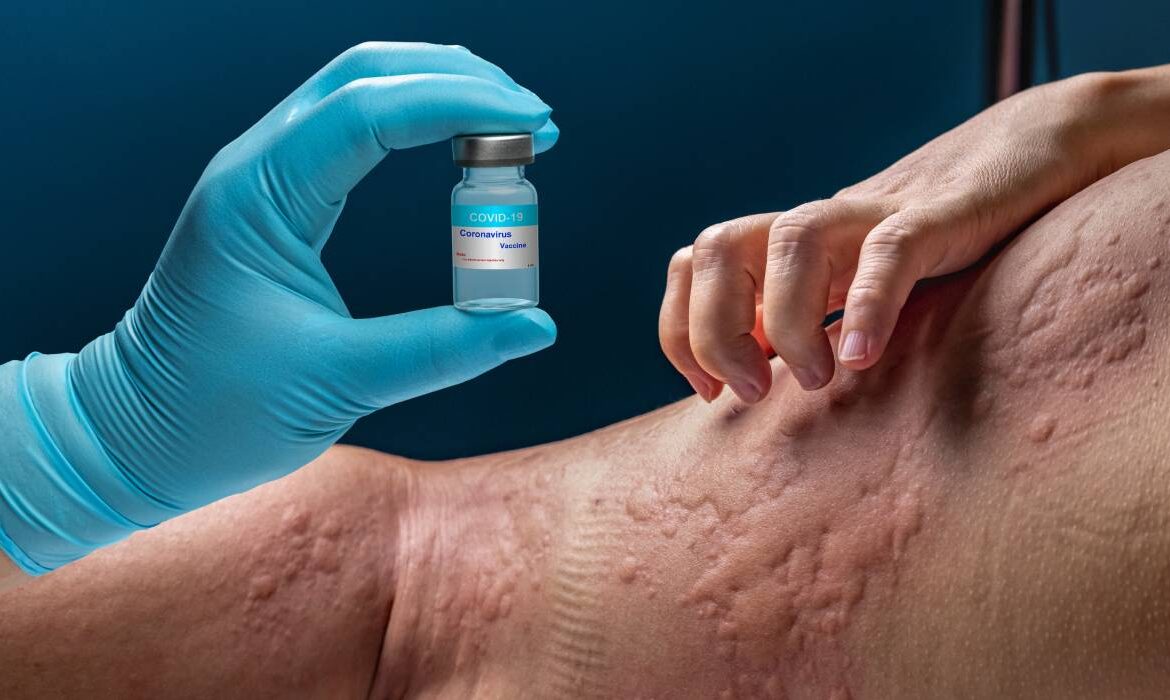 Povestea unei tinere cu peste 40 de alergii: cum i-a schimbat viața un tratament pentru astm. „Este prima dată când mănânc un măr după 10 ani”