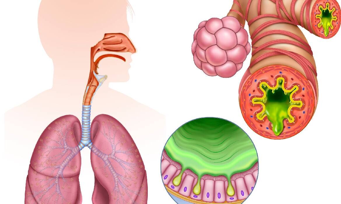 Inflamația cronică: „dușmanul invizibil” al sănătății moderne