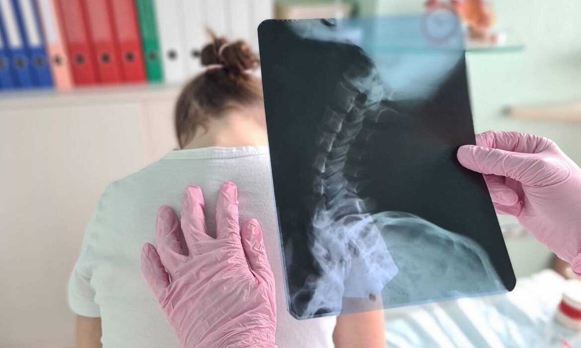 Postura copilului tău nu se îndreaptă singură. Ce ar trebui să știe orice părinte despre coloana vertebrală a copilului său