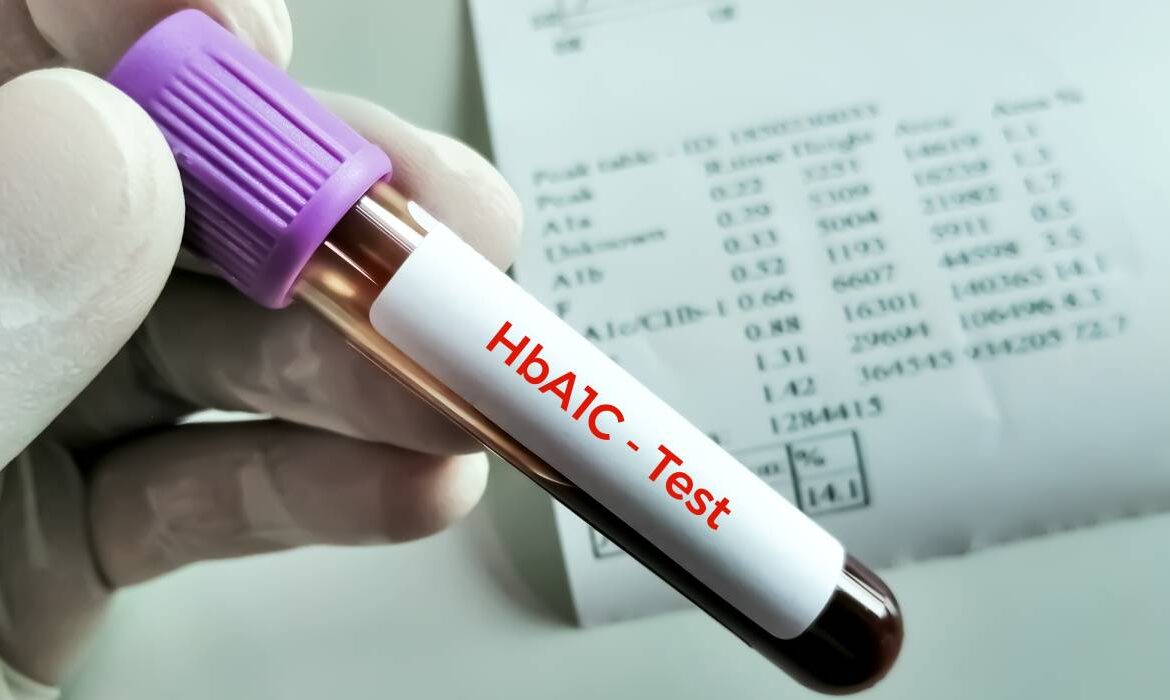De ce poate crește hemoglobina glicată (HbA1c)? Glicemia ridicată nu este singura explicație