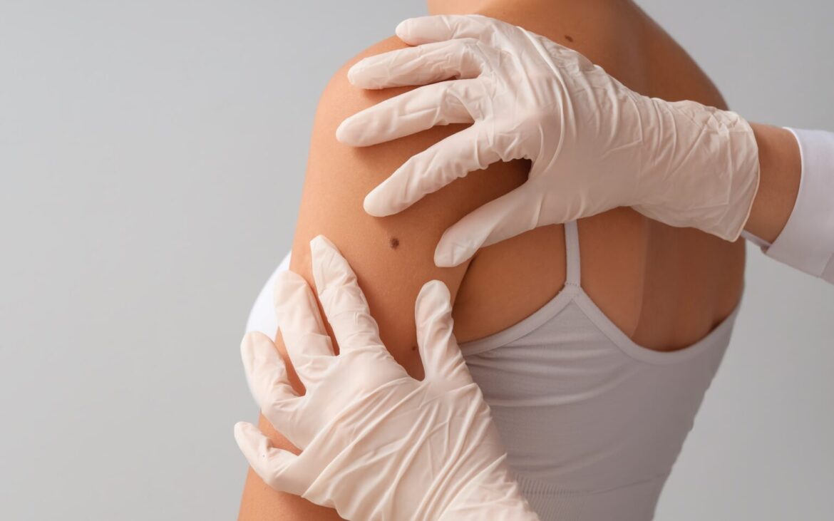 Cât costă să-ți verifici alunițele în Moldova. Lista prețurilor pentru dermatoscopie la clinici publice și private